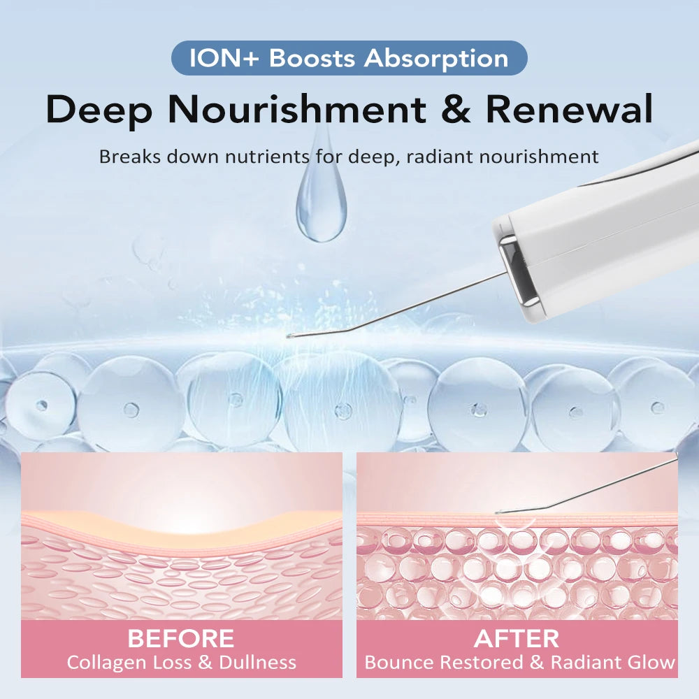 Ultrasonic Skin Scrubber EMS Face Lifting Machine Red Blue Light Blackhead Remover Pore Cleaner Deep Cleansing Facial Spatula