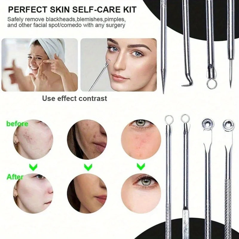 4Pcs Remover Pimple Comedone Extractor Tool Acne Removal Kit Treatment for Blemish,Risk Free Removal of Facial Blemishes