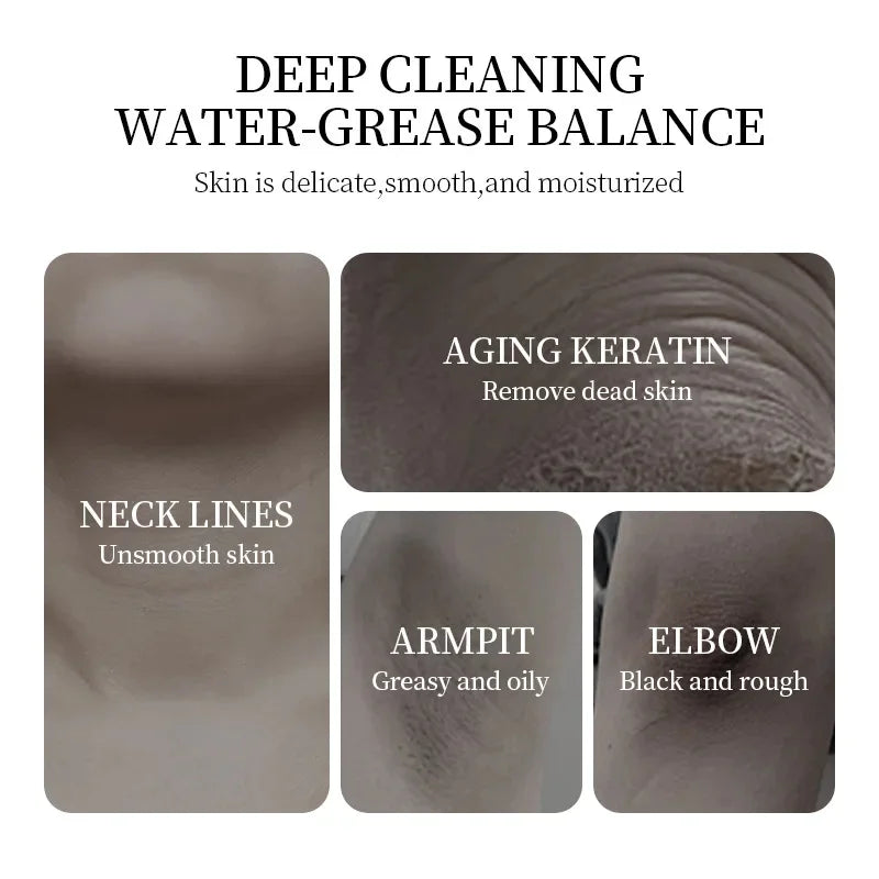 Retinol Whitening Cream Private Parts Underarm Bleaching Neck Lift  Firm Butt Knee Brighten Inner Thigh Dark Remove Melanin 60g
