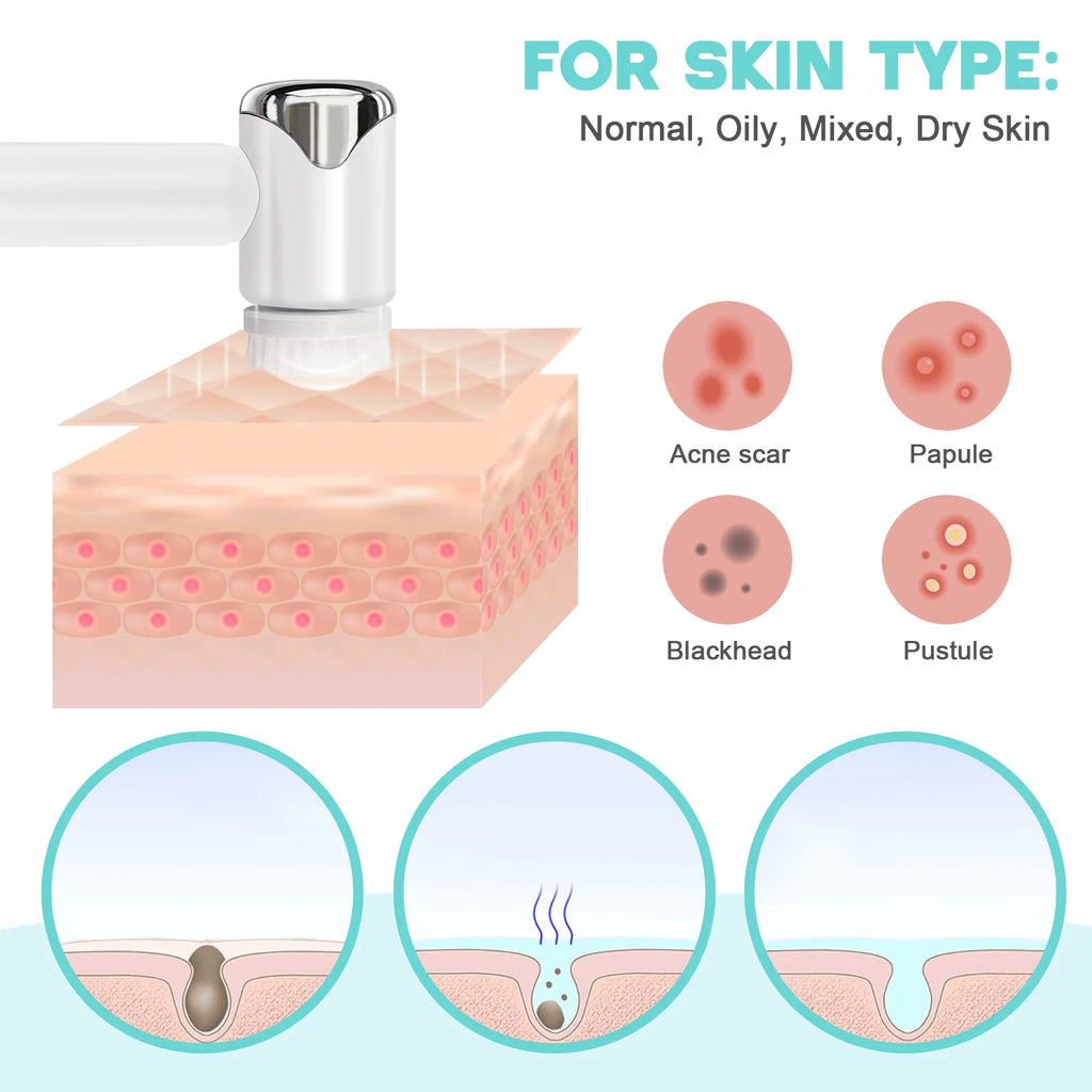 Electric Sonic Facial Cleansing Brush Waterproof Face Scrubber Deep Clean Exfoliating Skin Care Device