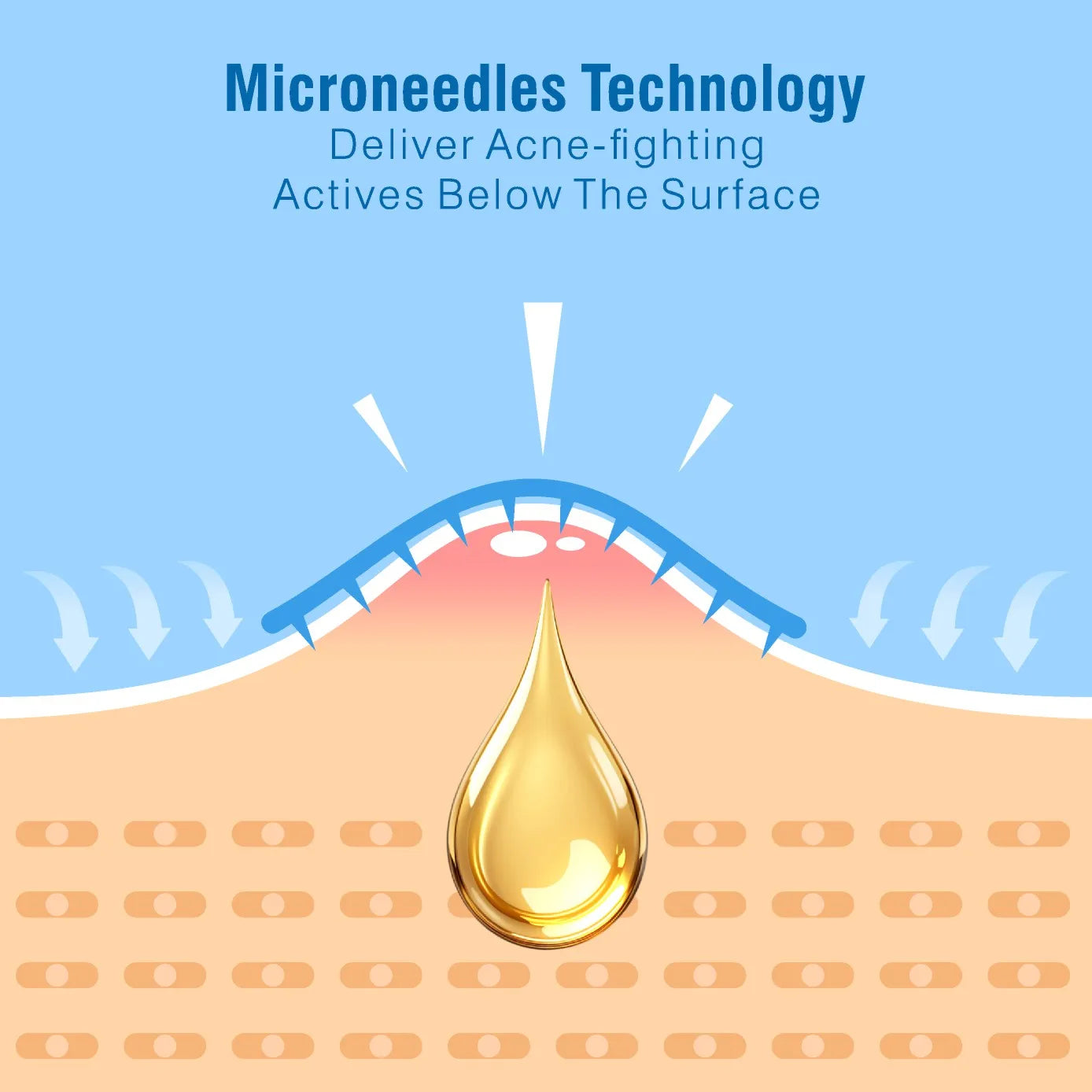 Microneedle Acne Patches | Foil-Wrapped, Portable, Alcohol-Free, Tea Tree & Witch Hazel