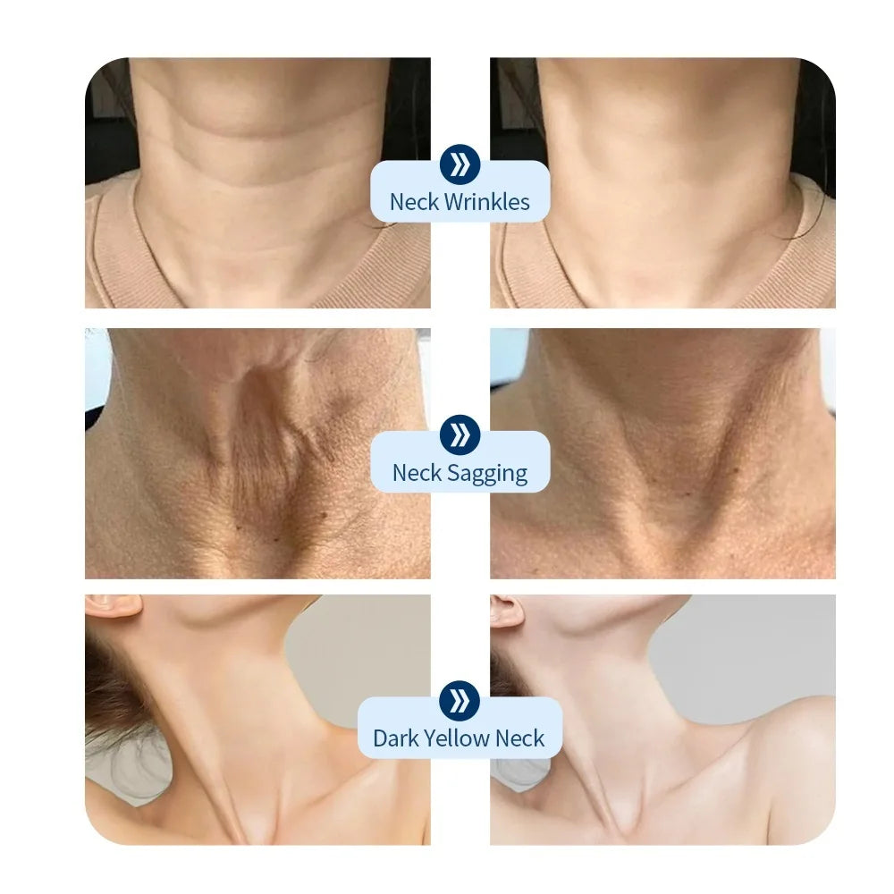 Neck Anti-aging Mask Skin Tightening Lifting Neck Beauty Device Brighten Skin Rejuvenation Improve Neck Muslc Sagging