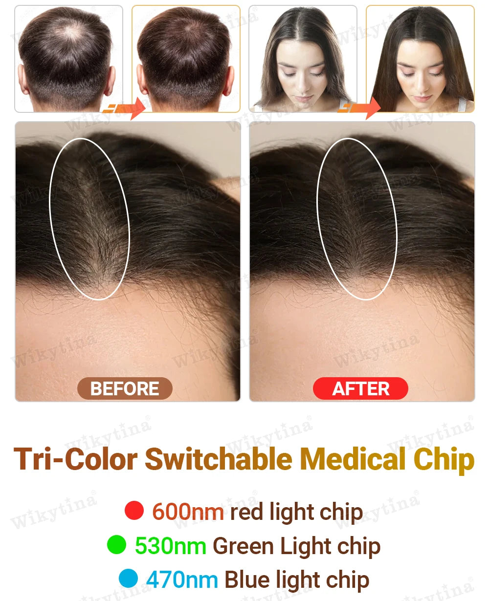 Clinical Grade LLLT Hair Regrowth Device Anti Hair Loss Machine For Scalp Health Thinning Hair Stress Anxiety Management