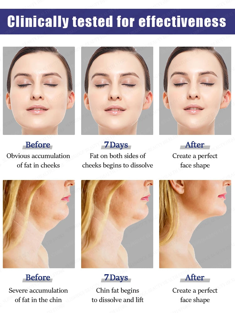Remove double chin