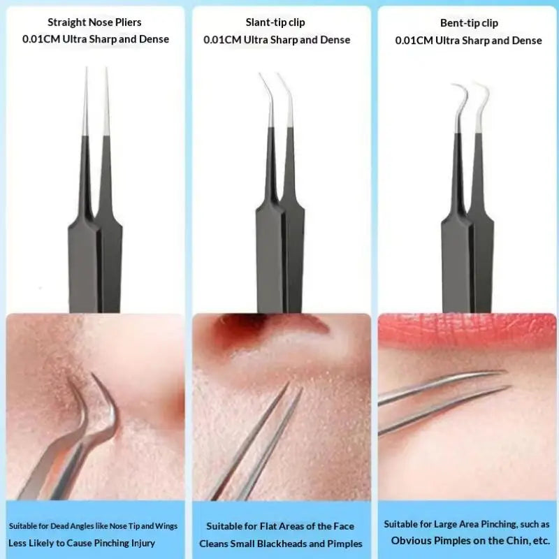 Blackhead Remover Pimple Popper Tool Set Reusable Safe Acne Extractor Kit for Daily Face Cleaning Use