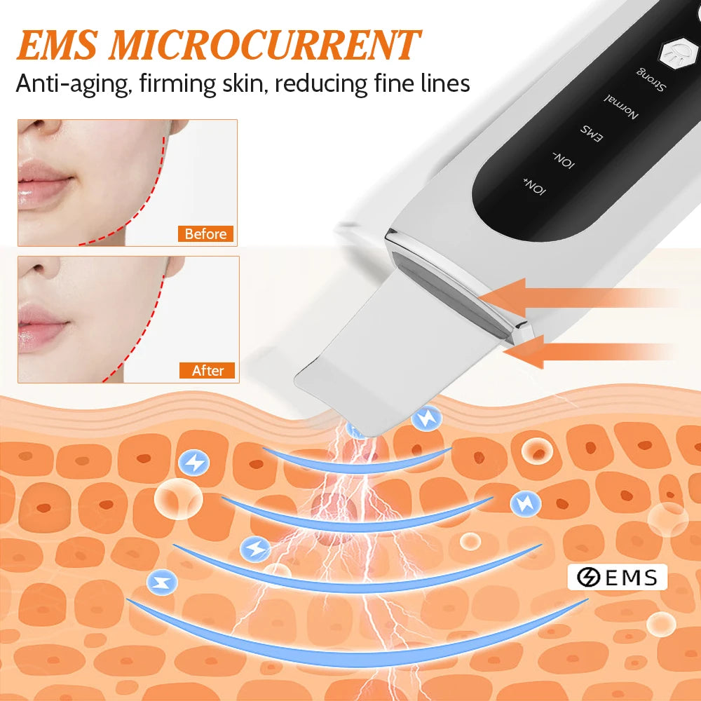 Ultrasonic Skin Scrubber EMS Face Lifting Machine Red Blue Light Blackhead Remover Pore Cleaner Deep Cleansing Facial Spatula