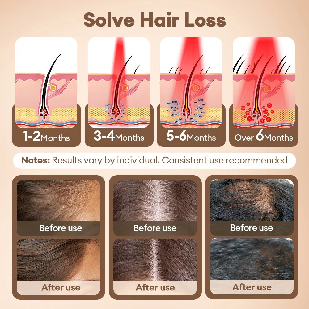 Red Light 650nm+850nm Infrared Hair Growth Cap Hair Loss Treatment Hat Anti Hair Loss Restore Hair Thickness Hair Regrowth Care