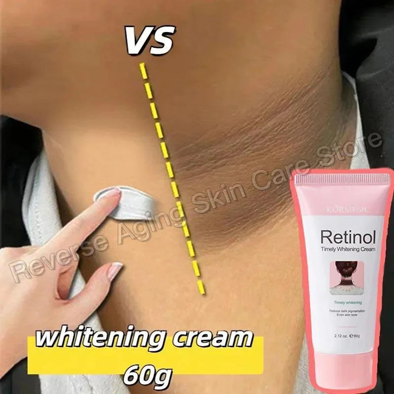 Retinol Whitening Cream Private Parts Underarm Bleaching Neck Lift  Firm Butt Knee Brighten Inner Thigh Dark Remove Melanin 60g