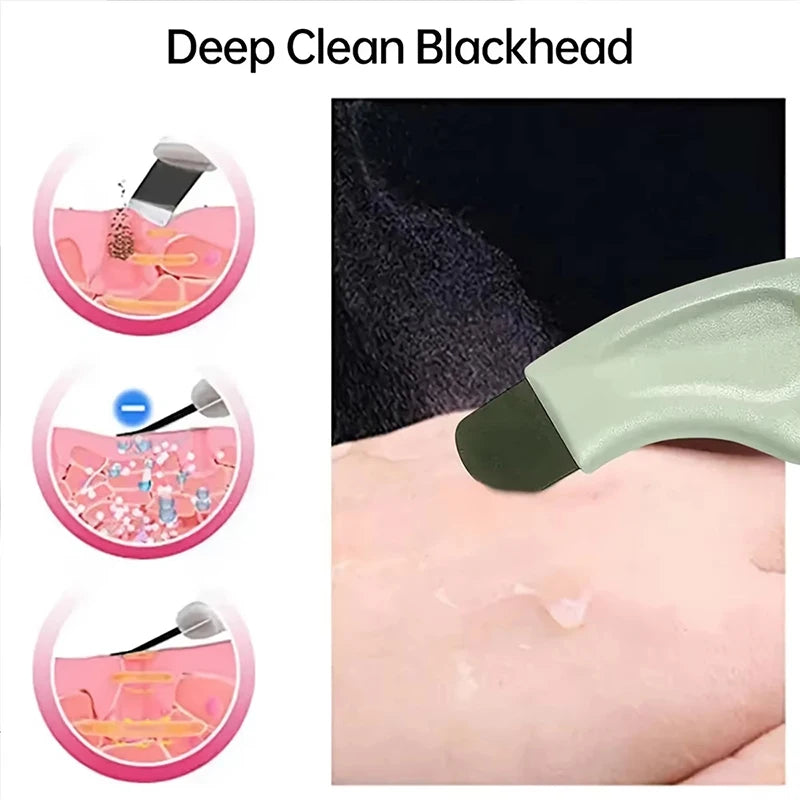 Deep Cleansing Beauty Tool Professional Blackhead Whitehead Remover Effective Pore Cleaner for Nose and Face Practical Skin Care