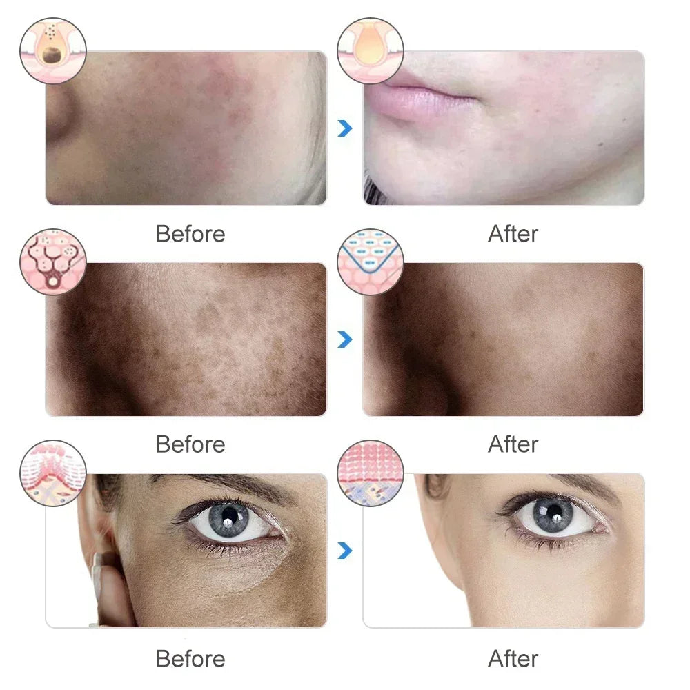 LED Face Mask Light Therapy 7 Colors Light Therapy Mask Skin Rejuvenation Tightening for Skin Care Anti Acne Wrinkles Whitening