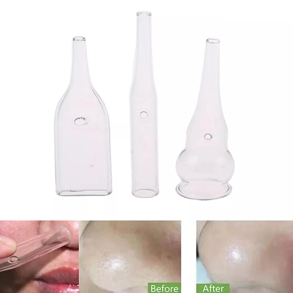 1Pc Vacuum Suction Tube Face Pore Cleanser Glass Pipes Blackhead Removal Extractor Beauty Machine Facial Skin Care Accessories
