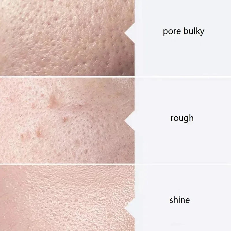 3PCS Skincare Deep Cleansing AS1 SA2 AO3 Water based Exfoliating Liquid Pore Shrinking Moisturizing Liquid Beauty Salon Facial