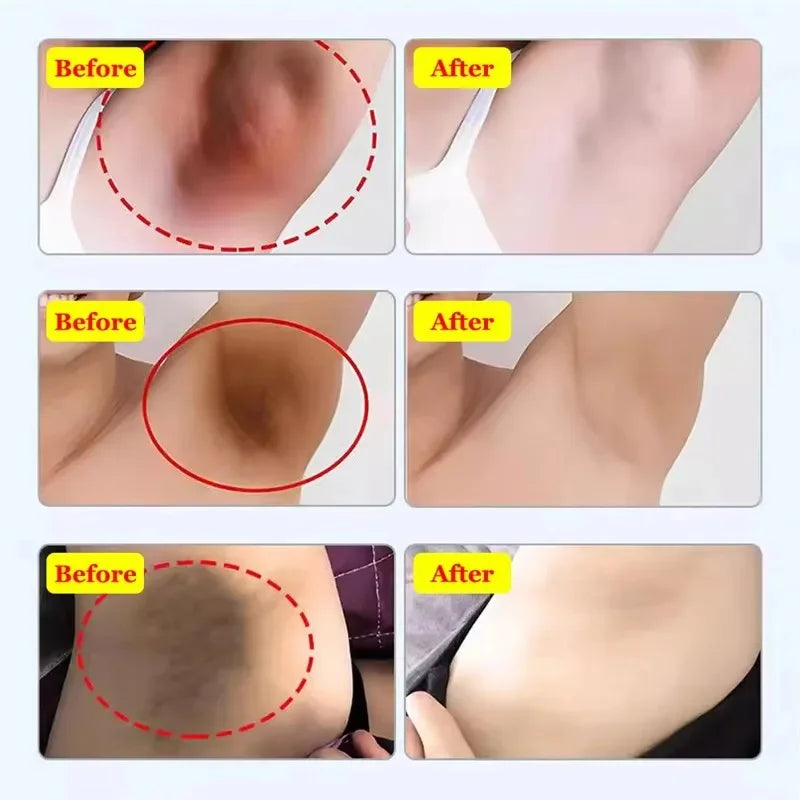 Retinol Whitening Cream Private Parts Underarm Bleaching Neck Lift  Firm Butt Knee Brighten Inner Thigh Dark Remove Melanin 60g