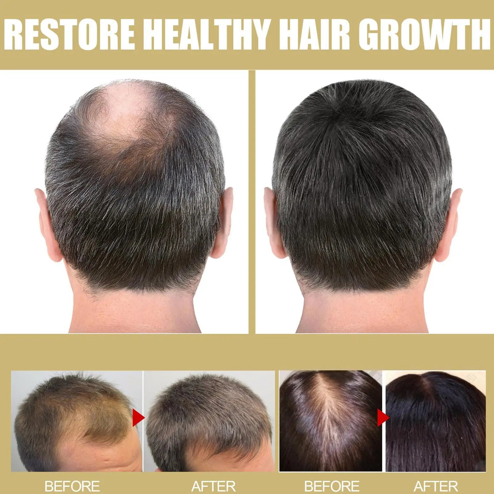 Hair Growth Cap Infrared Cap To Reduce Alopecia & Shedding Hair Growth Device Prevents Alopecia with LED Light for Men Women