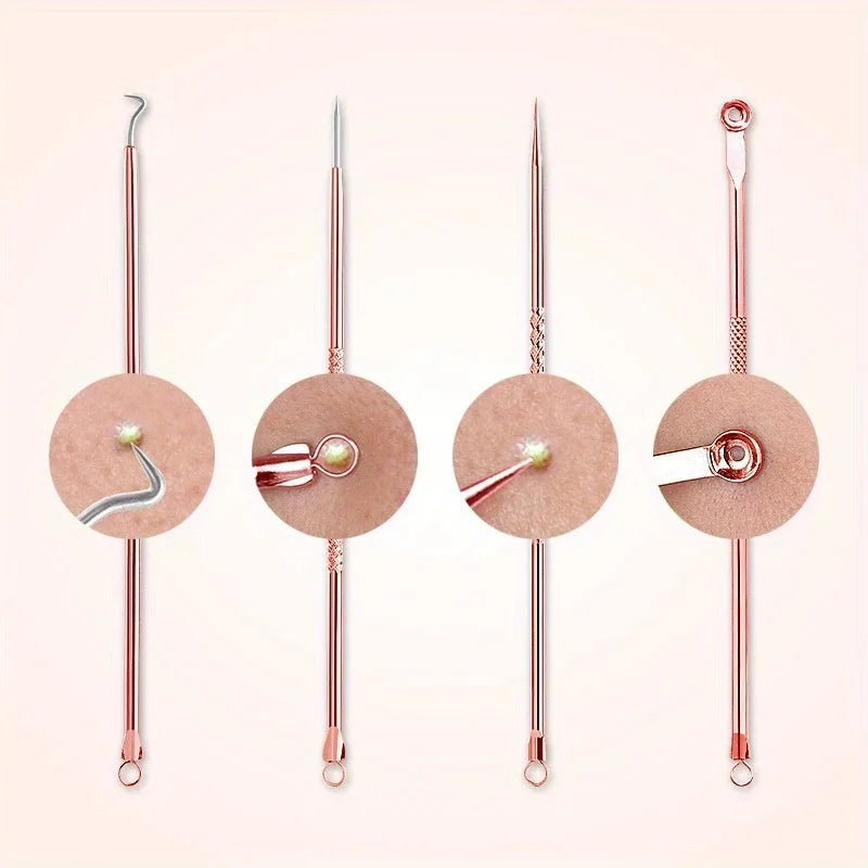 4Pcs Remover Pimple Comedone Extractor Tool Acne Removal Kit Treatment for Blemish,Risk Free Removal of Facial Blemishes