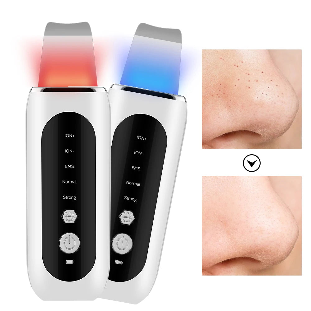 Ultrasonic Skin Scrubber EMS Face Lifting Machine Red Blue Light Blackhead Remover Pore Cleaner Deep Cleansing Facial Spatula