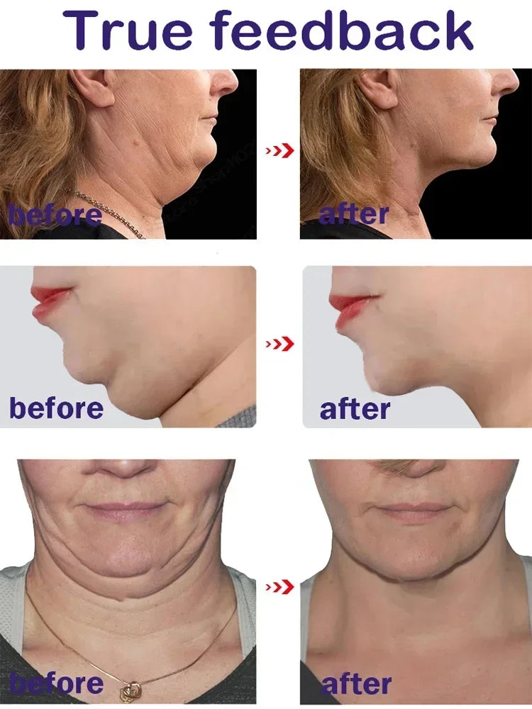 Effective Skinny Face Cream Miracle Product V Series Skinny Face Double Chin Remover Lifting Double Chin Cream