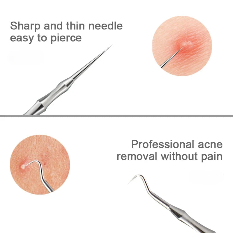 Beauty Artifact Blemish Extractor Remover Needle Tool Acne Blackhead Removal Needles Pimples Blackhead Clip Tweezers